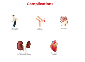 All About Tuberculosis Types Symptoms Diagnosis And More