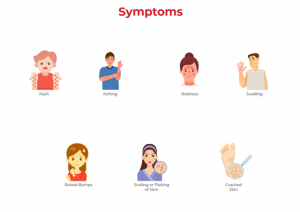 Skin Allergy Types Causes Symptoms Prevention Lal PathLabs