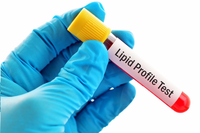 Cholesterol Test Lipid Panel 