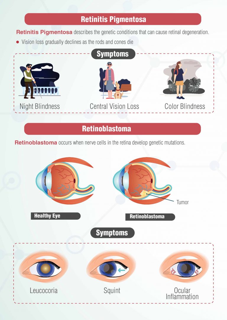 Inherited Retinal Diseases: Retinitis Pigmentosa | Retinoblastoma