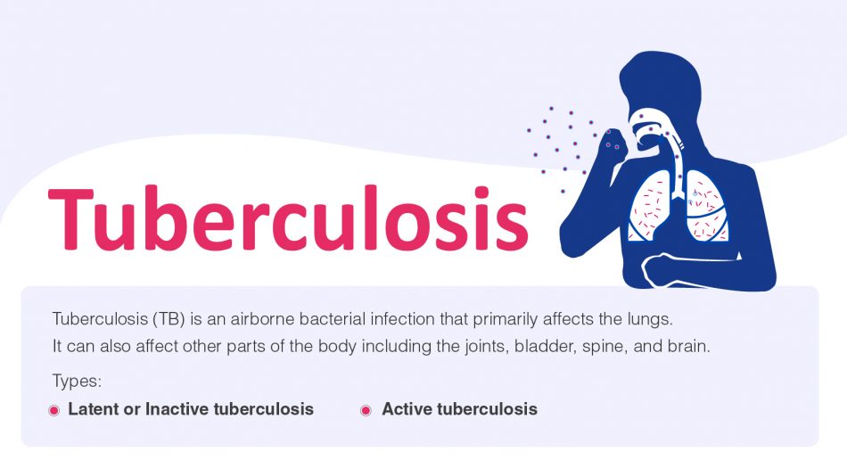 Tuberculosis: Signs, Symptoms, Risk Factors, Causes & Treatment