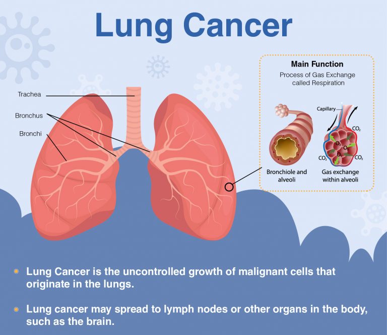 does dead space in lung mean that percentage of lung is not in use