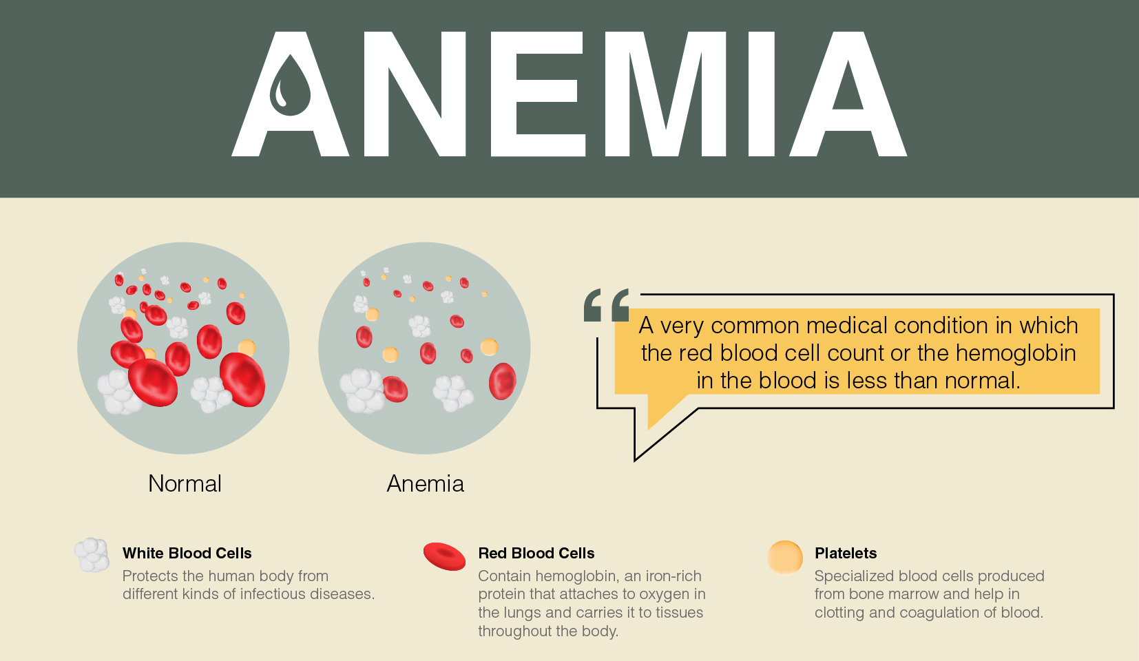 Overview of Anemia Signs, Symptoms, Causes and Treatment