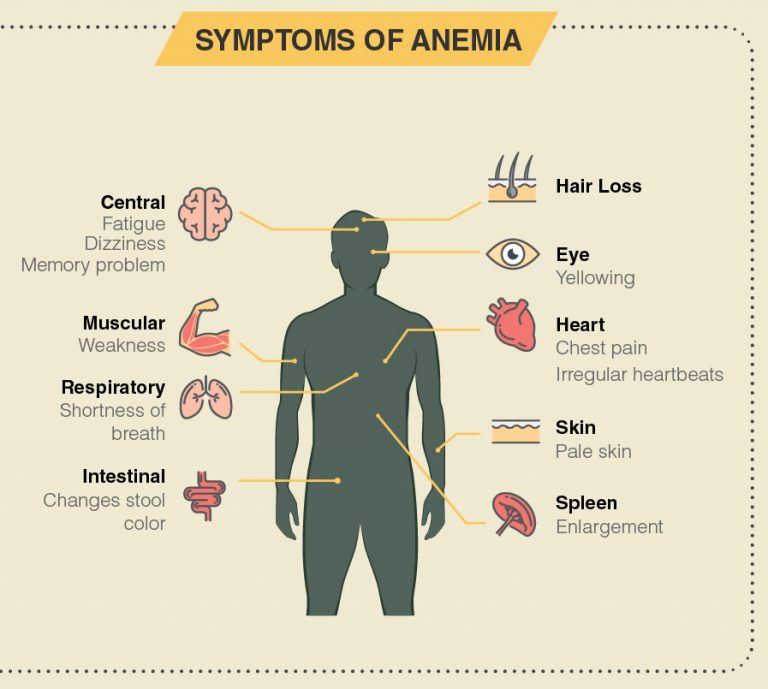 Overview Of Anemia Signs Symptoms Causes And Treatment 7641