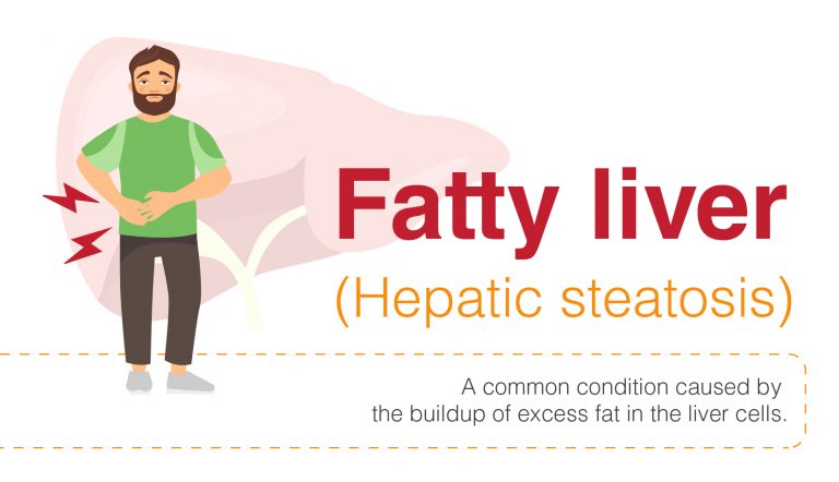 Overview Of Fatty Liver Signs Symptoms And Diagnosis