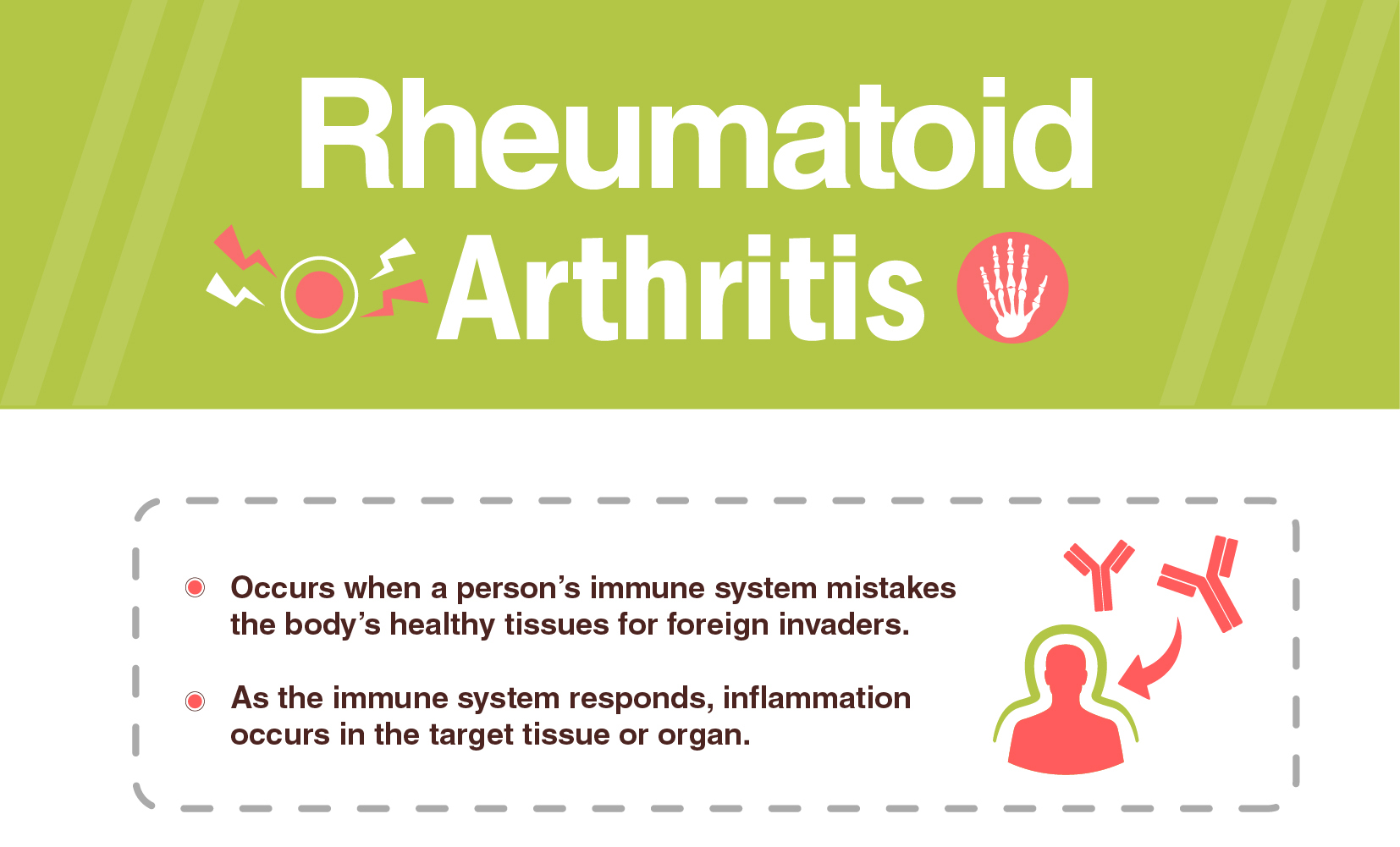 Rheumatoid Arthritis Signs, Symptoms & Treatment Dr Lal PathLabs Blog