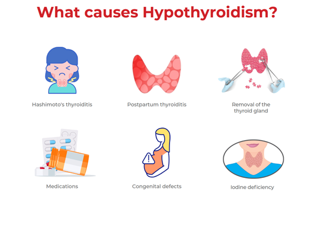 causes of hypothyroidism