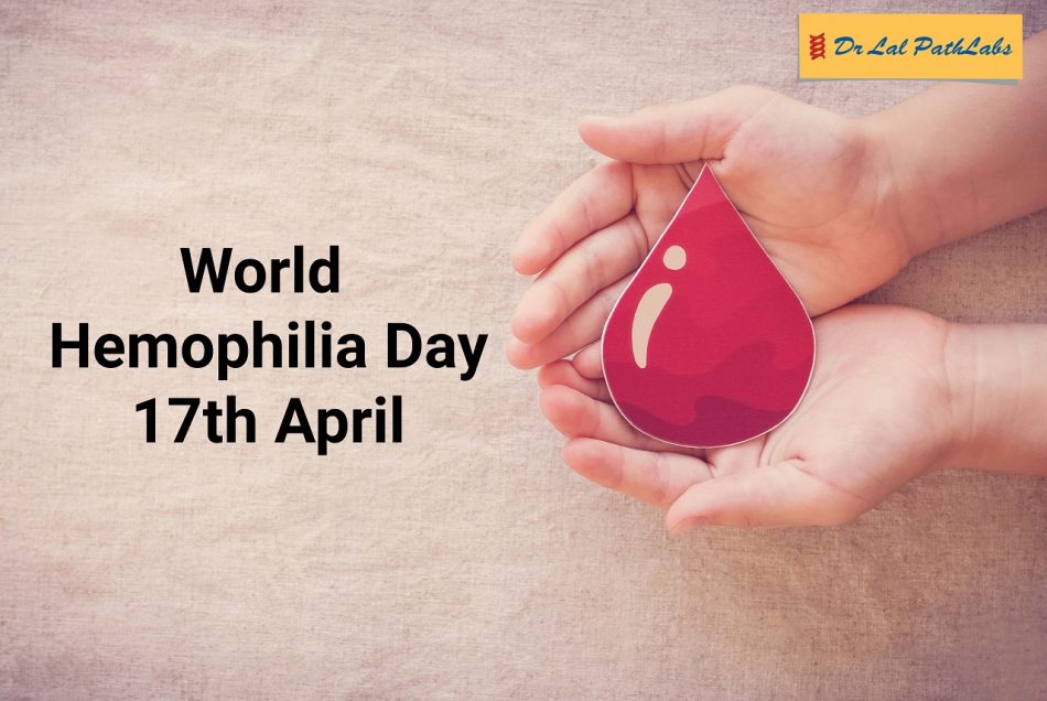 Hemophilia: Causes, Symptoms And Diagnosis | Lal PathLabs