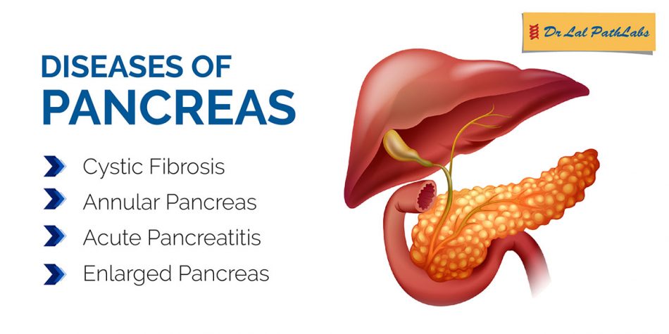 Disease Of Pancreas 950x475 