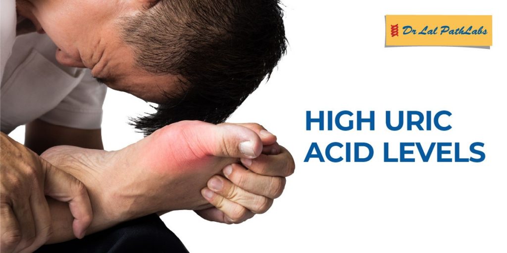 Understanding High Uric Acid Levels: Symptoms, Diagnosis, and ...