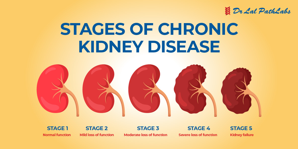 Kidney Disease Types Symptoms Diagnosis Dr Lal PathLabs Blog