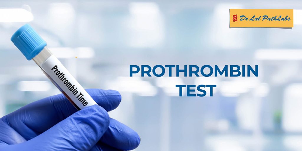 accurate-prothrombin-time-test-and-pt-inr-measurement-dr-lal-pathlabs