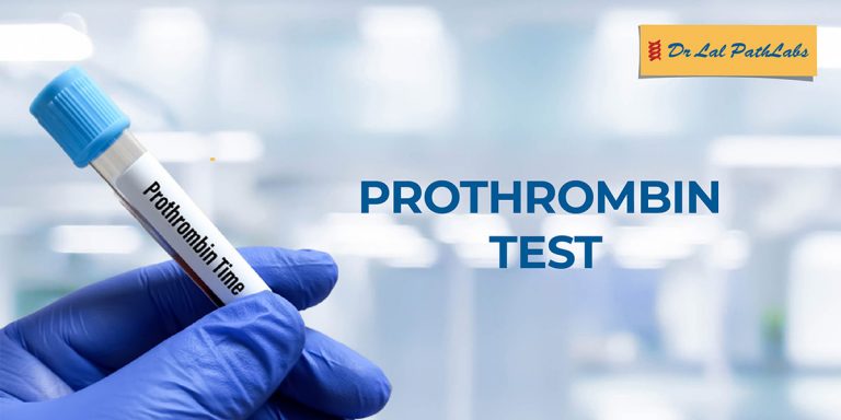 Accurate Prothrombin Time Test And PT INR Measurement | Dr. Lal PathLabs