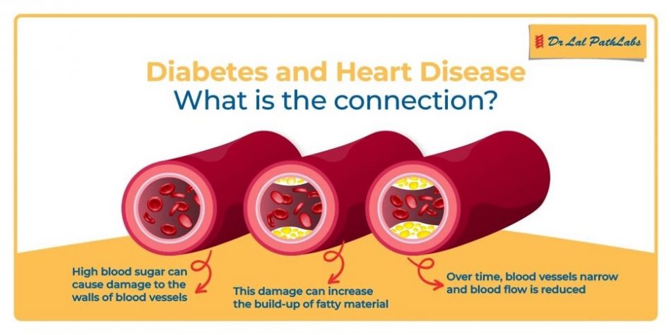 diabetes-and-heart-diseases-how-diabetes-affects-the-heart-dr-lal