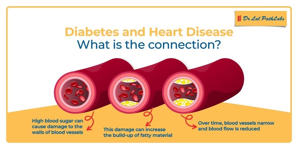 Diabetes And Heart Diseases How Diabetes Affects The Heart Dr Lal 