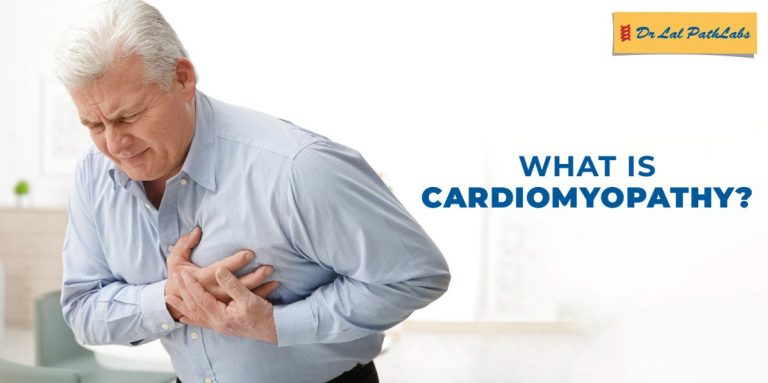 Cardiomyopathy Symptoms And Diagnosis Dr Lal Pathlabs Blogs